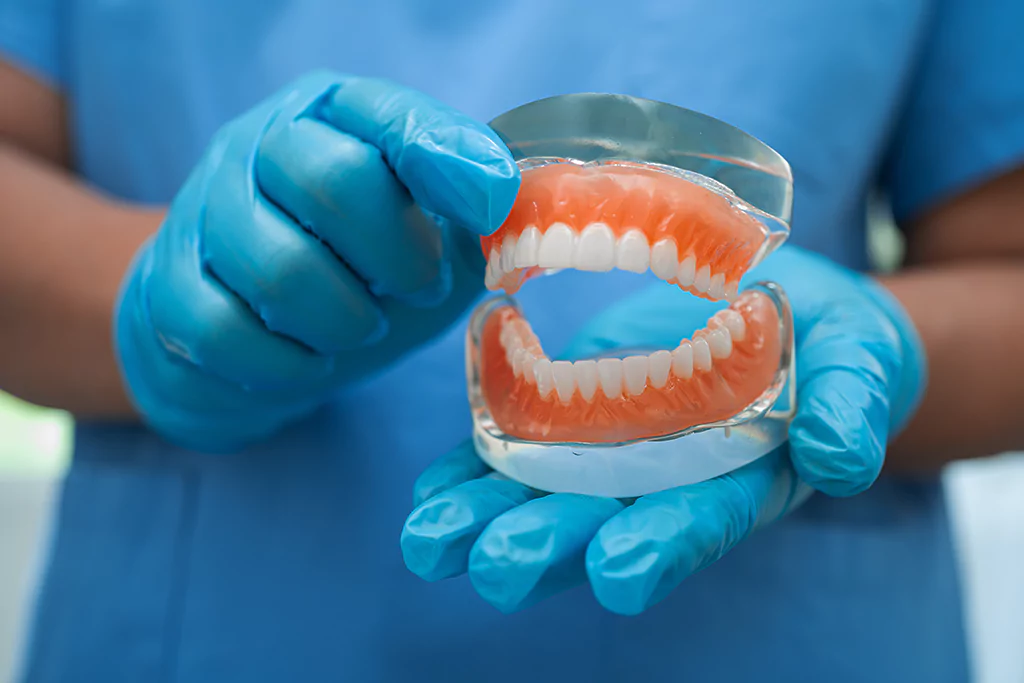 Why Dental Bridges in Costa Rica Are a Great Option?